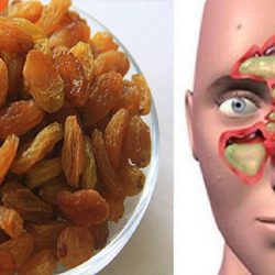 Sinüzit için Zencefil Üzüm