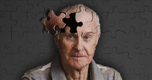 Alzheimer Hastalığı