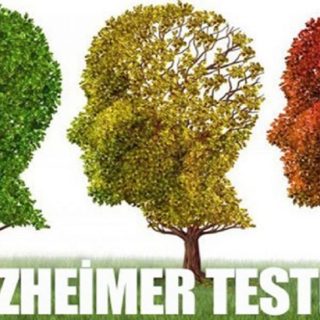 Alzheimer Testi