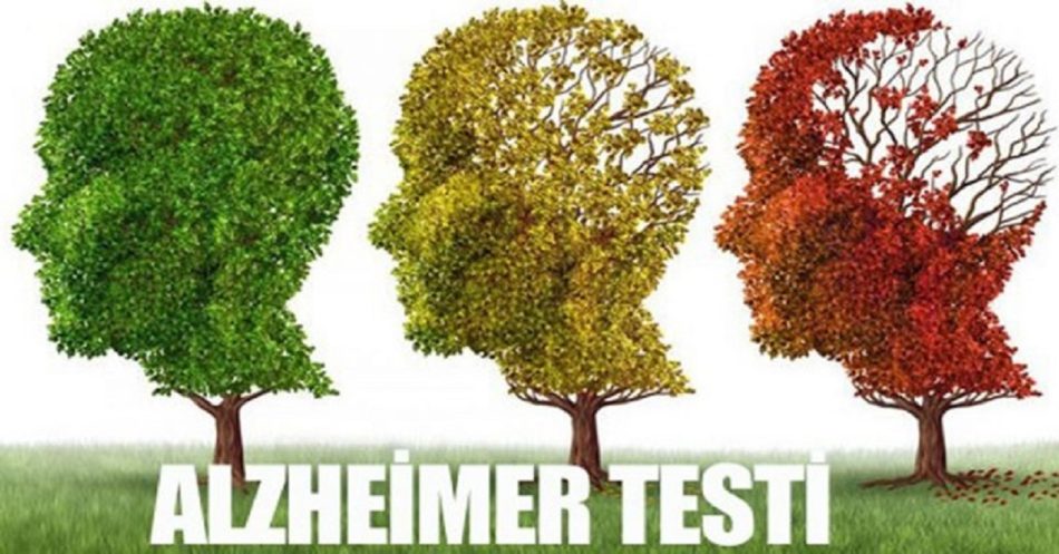 Alzheimer Testi
