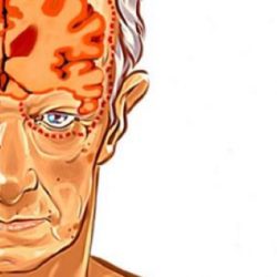 Alzheimer Önlemleri