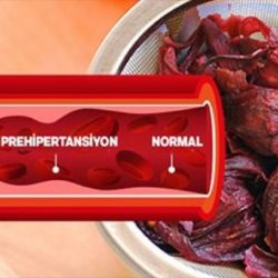 tansiyon düşüren besinler